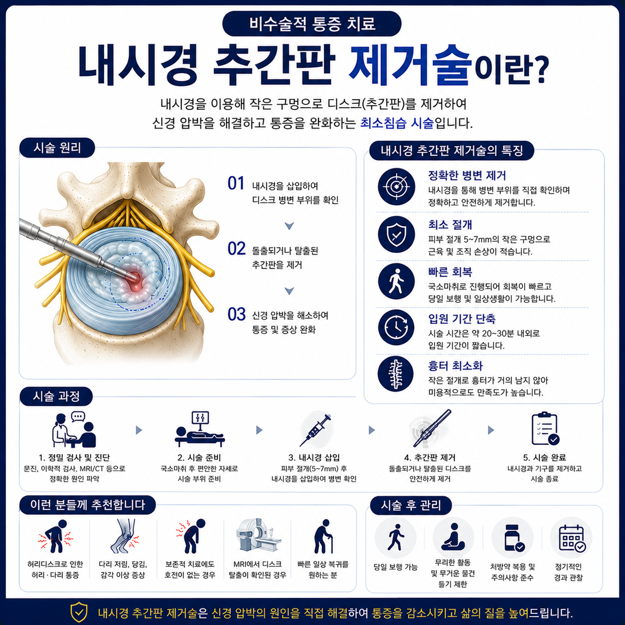 내시경 추간판 제거술.png