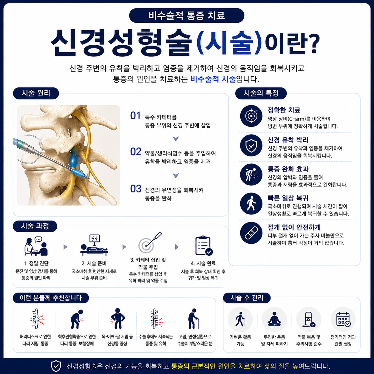 신경성형술.png