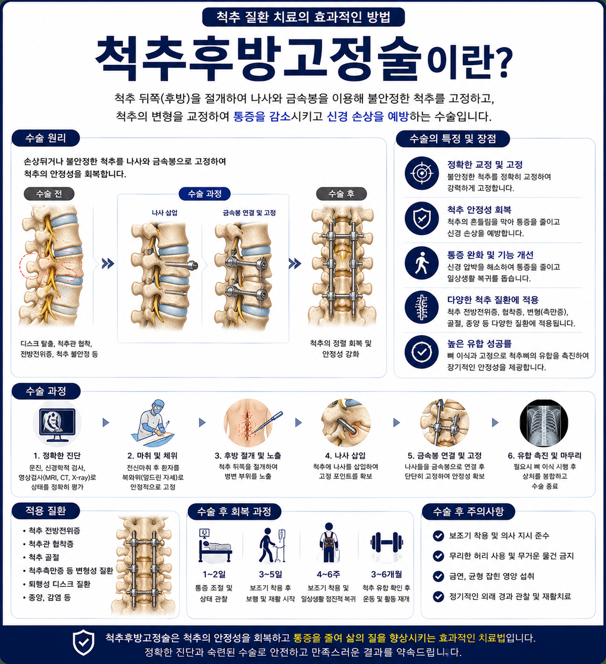 척추후방고정술.png